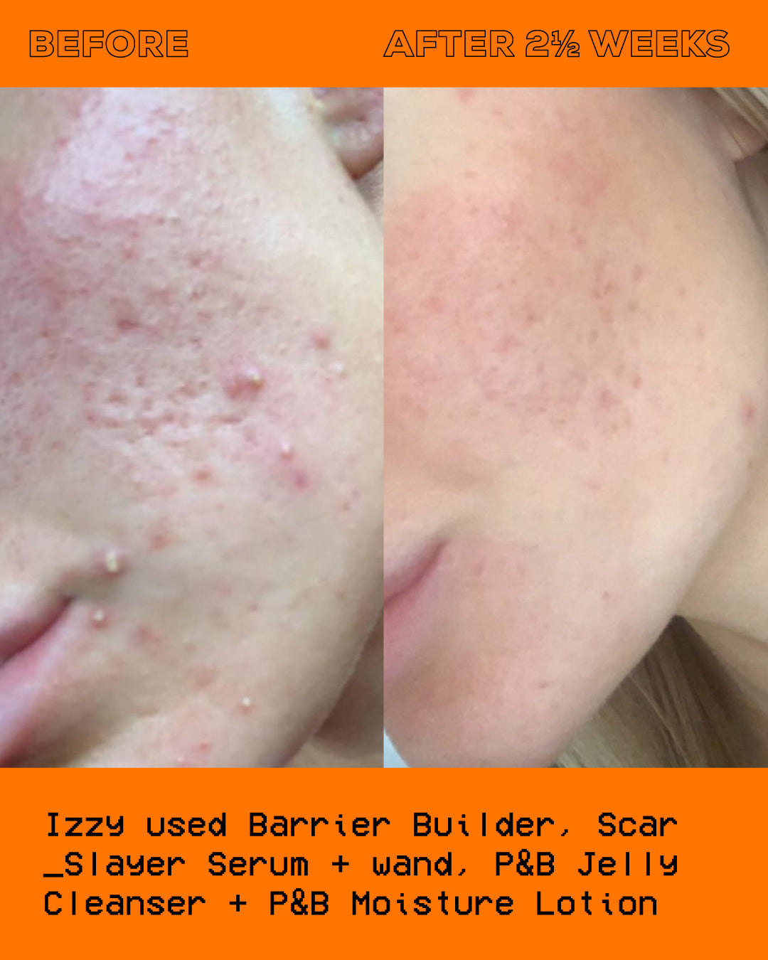 The Scar Slayer Facial Serum 30ml