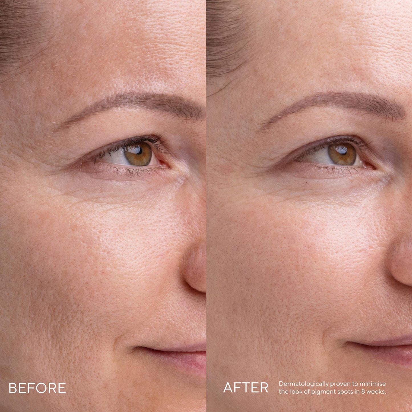 Kojic Alternative Pigment Serum 30ml